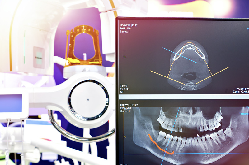 Nomad Ultra-Low Radiation X-Rays in Henderson